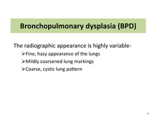 common neonatal Radiology findings | PPT