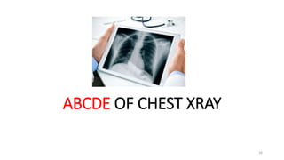 Abc Radiografhy Radiology for radiation oncologist | PPTX