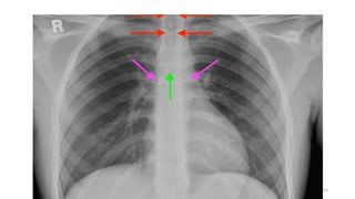 Radiology for radiation oncologist | PPTX
