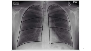 Radiology for radiation oncologist | PPTX