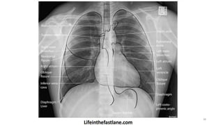 Radiology for radiation oncologist | PPTX