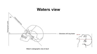 Walters View RADIOLOGY full extraoral radiology .pptx