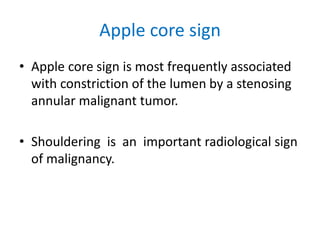 Radiology GIT.ppt