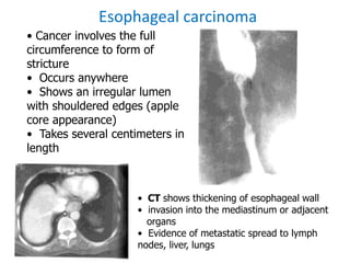 Radiology GIT.ppt