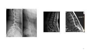 Spine Development Radiology Comprehensive Radioimaging and Anatomy of the Spine: X-ray and MRI ...