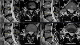 Spine Development Radiology Comprehensive Radioimaging and Anatomy of the Spine: X-ray and MRI ...