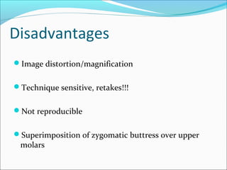 Disadvantages
Image distortion/magnification
Technique sensitive, retakes!!!
Not reproducible
Superimposition of zygomatic buttress over upper
molars
 