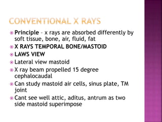 Radiology in ent | PPTX