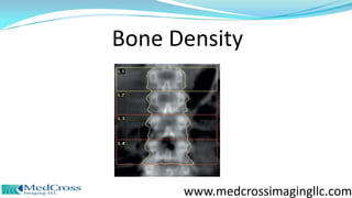 Bone Density
www.medcrossimagingllc.com