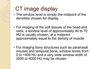 Window Level Radiology Button Radiology in Head and Neck by Kanato T Assumi. | PPTX
