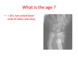 What is the age ?
• < 20 ( non united lower
ends of radius and ulna)
 