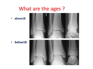 What are the ages ?
• above18
• below18
 