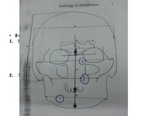 Comparative identification
Cephalometric indices
• 8 measurments used for the comparison:
1. 5 breadthes:
I. Bigonial
II. Bimaxillary
III. Bizygomatic
IV. Maximum cranial
V. Sinus
2. 3 heights:
I. Mastoid to apex
II. Total facial
III. Incisor height
 