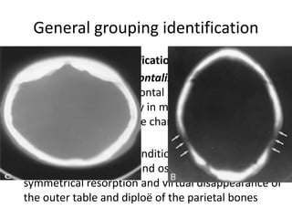 General grouping identification
Sex identification: Skull
• Hyperostosis interna frontalis is an overgrowth of
the inner table of the frontal bone, often florid,
found almost exclusively in middle-aged or older
females and is a valuable characteristic for sex
determination .
• Parietal thinning is a condition of postmenopausal
females in which profound osteoporosis causes
symmetrical resorption and virtual disappearance of
the outer table and diploë of the parietal bones
 