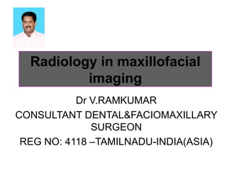Radiology in maxillofacial
imaging
Dr V.RAMKUMAR
CONSULTANT DENTAL&FACIOMAXILLARY
SURGEON
REG NO: 4118 –TAMILNADU-INDIA(ASIA)
 