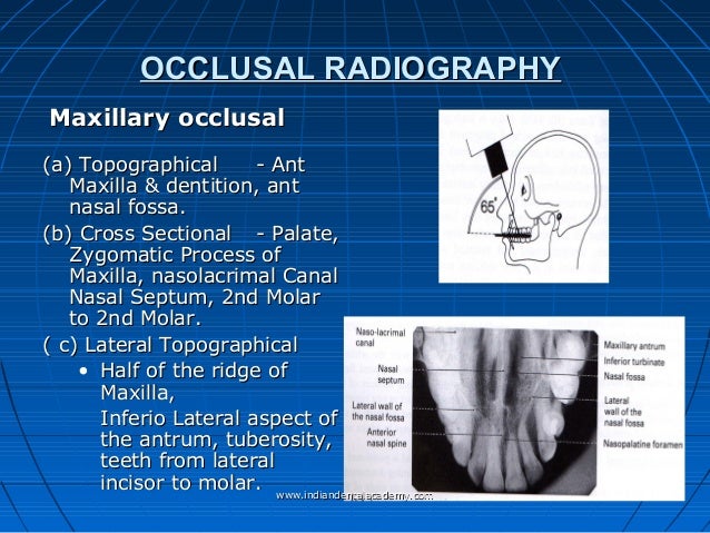 Radiology in orthodontics dr.kavitha /certified fixed orthodontic cou…