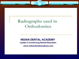 Radiographs used in
   Orthodontics

 INDIAN DENTAL ACADEMY
 Leader in Continuing Dental Education
    www.indiandentalacademy.com




 www.indiandentalacademy.com
 