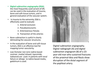 • Digital subtraction angiography (DSA),
the most frequently used variant of DR,
can be used in the evaluation of trauma,
bone and soft-tissue tumors, and in
general evaluation of the vascular system.
• In trauma to the extremity, DSA is
effectively used to evaluate
1. Arterial occlusion
2. Pseudoaneurysms
3. Arteriovenous fistulas
4. Transection of the arteries
• Bone subtraction is useful in clearly
delineating the vascular structures.
• In the evaluation of bone and soft-tissue
tumors, DSA is an effective tool for
mapping tumor vascularity.
• Low Osmolar non ionic iodine based
contrast media( Iohexol, Iopromide,
Iodixanol) are used. In patients with renal
failure or allergic to iodine based media,
gadolinum is used.
Digital subtraction angiography.
Digital radiograph (A) and digital
subtraction angiogram (B) of a 23-
year-old man who sustained fractures
of the proximal tibia and fibula show
disruption of the distal segment of
the popliteal artery.
 