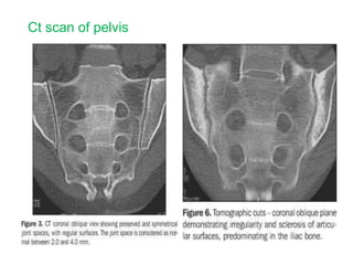 Ct scan of pelvis
 
