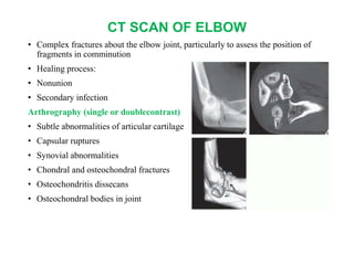 CT SCAN OF ELBOW
• Complex fractures about the elbow joint, particularly to assess the position of
fragments in comminution
• Healing process:
• Nonunion
• Secondary infection
Arthrography (single or doublecontrast)
• Subtle abnormalities of articular cartilage
• Capsular ruptures
• Synovial abnormalities
• Chondral and osteochondral fractures
• Osteochondritis dissecans
• Osteochondral bodies in joint
 