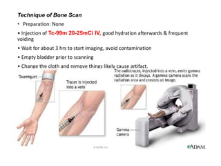 Technique of Bone Scan
• Preparation: None
• Injection of Tc-99m 20-25mCi IV, good hydration afterwards & frequent
voiding
• Wait for about 3 hrs to start imaging, avoid contamination
• Empty bladder prior to scanning
• Change the cloth and remove things likely cause artifact.
 