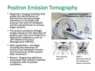 Positron Emission Tomography
• Diagnostic imaging modality that
allows the identification of
biochemical and physiologic
alterations in the body and
assesses the level of metabolic
activity and perfusion in various
organ systems.
• The process produces biologic
images based on the detection of
gamma rays that are emitted by a
radioactive substance, such as
18F-labeled 2-fluoro-2-
deoxyglucose (18FDG).
• Main application : oncology
including the detection of
primary and metastatic tumors
and recurrences of the tumors
after treatment
• Recent : Diagnosing infections
associated with metallic implants
in patients with traumatic
conditions
Normal whole
body PET
Stage 4
adenocarcinoma pt
with widespread
skeletal metastases
 