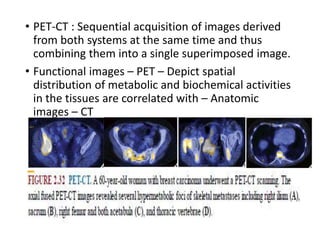• PET-CT : Sequential acquisition of images derived
from both systems at the same time and thus
combining them into a single superimposed image.
• Functional images – PET – Depict spatial
distribution of metabolic and biochemical activities
in the tissues are correlated with – Anatomic
images – CT
 
