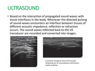 ULTRASOUND
• Based on the interaction of propagated sound waves with
tissue interfaces in the body. Whenever the directed pulsing
of sound waves encounters an interface between tissues of
different acoustic impedance, reflection or refraction
occurs. The sound waves reflected back to the US
transducer are recorded and converted into images.
Curvilinear echogenic focus with acoustic
shadowing sec to intrasubstance calcification-
calcific tendinitis
 