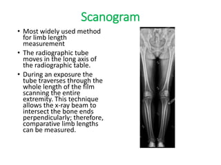 Scanogram
• Most widely used method
for limb length
measurement
• The radiographic tube
moves in the long axis of
the radiographic table.
• During an exposure the
tube traverses through the
whole length of the film
scanning the entire
extremity. This technique
allows the x-ray beam to
intersect the bone ends
perpendicularly; therefore,
comparative limb lengths
can be measured.
 