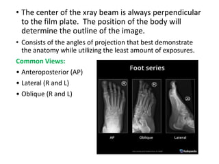 • The center of the xray beam is always perpendicular
to the film plate. The position of the body will
determine the outline of the image.
• Consists of the angles of projection that best demonstrate
the anatomy while utilizing the least amount of exposures.
Common Views:
• Anteroposterior (AP)
• Lateral (R and L)
• Oblique (R and L)
 