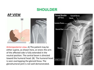 SHOULDER
AP VIEW
Anteroposterior view. A) The patient may be
either supine, as shown here, or erect; the arm
of the affected side is fully extended in the
neutral position. The central beam is directed
toward the humeral head. (B) The humeral head
is seen overlapping the glenoid fossa. The
glenohumeral joint is not well demonstrated.
 
