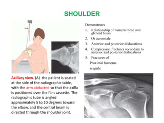 SHOULDER
Demonstrates
1. Relationship of humeral head and
glenoid fossa
2. Os acromiale
3. Anterior and posterior dislocations
4. Compression fractures secondary to
anterior and posterior dislocations
5. Fractures of
Proximal humerus
scapula
Axillary view. (A) the patient is seated
at the side of the radiographic table,
with the arm abducted so that the axilla
is positioned over the film cassette. The
radiographic tube is angled
approximately 5 to 10 degrees toward
the elbow, and the central beam is
directed through the shoulder joint.
 