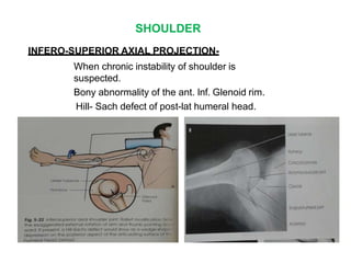 SHOULDER
INFERO-SUPERIOR AXIAL PROJECTION-
When chronic instability of shoulder is
suspected.
Bony abnormality of the ant. Inf. Glenoid rim.
Hill- Sach defect of post-lat humeral head.
 