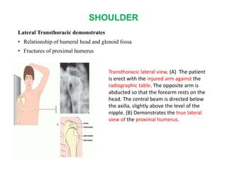 SHOULDER
Lateral Transthoracic demonstrates
• Relationship of humeral head and glenoid fossa
• Fractures of proximal humerus
Transthoracic lateral view. (A) The patient
is erect with the injured arm against the
radiographic table. The opposite arm is
abducted so that the forearm rests on the
head. The central beam is directed below
the axilla, slightly above the level of the
nipple. (B) Demonstrates the true lateral
view of the proximal humerus.
 