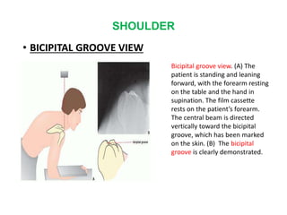 SHOULDER
• BICIPITAL GROOVE VIEW
Bicipital groove view. (A) The
patient is standing and leaning
forward, with the forearm resting
on the table and the hand in
supination. The film cassette
rests on the patient’s forearm.
The central beam is directed
vertically toward the bicipital
groove, which has been marked
on the skin. (B) The bicipital
groove is clearly demonstrated.
 