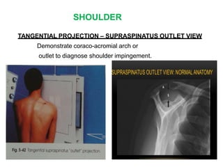SHOULDER
TANGENTIAL PROJECTION – SUPRASPINATUS OUTLET VIEW
Demonstrate coraco-acromial arch or
outlet to diagnose shoulder impingement.
 