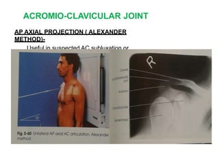 ACROMIO-CLAVICULAR JOINT
AP AXIAL PROJECTION ( ALEXANDER
METHOD)-
Useful in suspected AC subluxation or
dislocation.
 