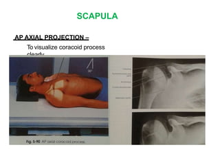 SCAPULA
AP AXIAL PROJECTION –
To visualize coracoid process
clearly.
 