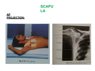 SCAPU
LA
AP
PROJECTION-
 