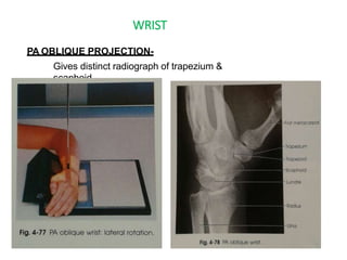 WRIST
PA OBLIQUE PROJECTION-
Gives distinct radiograph of trapezium &
scaphoid.
 