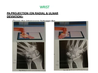 WRIST
PA PROJECTION (ON RADIAL & ULNAR
DEVIATION)-
Opens the interspaces between the
carpals.
 