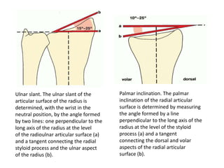 Ulnar slant. The ulnar slant of the
articular surface of the radius is
determined, with the wrist in the
neutral position, by the angle formed
by two lines: one perpendicular to the
long axis of the radius at the level
of the radioulnar articular surface (a)
and a tangent connecting the radial
styloid process and the ulnar aspect
of the radius (b).
Palmar inclination. The palmar
inclination of the radial articular
surface is determined by measuring
the angle formed by a line
perpendicular to the long axis of the
radius at the level of the styloid
process (a) and a tangent
connecting the dorsal and volar
aspects of the radial articular
surface (b).
 