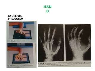 HAN
D
PA OBLIQUE
PROJECTION-
 