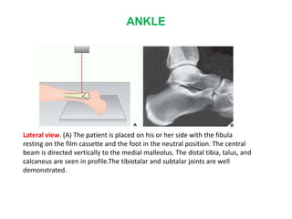 ANKLE
Lateral view. (A) The patient is placed on his or her side with the fibula
resting on the film cassette and the foot in the neutral position. The central
beam is directed vertically to the medial malleolus. The distal tibia, talus, and
calcaneus are seen in profile.The tibiotalar and subtalar joints are well
demonstrated.
 