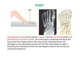 FOOT
Anteroposterior view. (A) The patient is supine, with the knee flexed and the sole
placed firmly on the film cassette. The central beam is directed vertically to the
base of the first metatarsal bone. (B) injury to the metatarsal bones and
phalanges can be adequately assessed. (C) The first intermetatarsal angle is
formed by the intersection of the lines bisecting the shafts of the first (a) and
second (b) metatarsals.
 