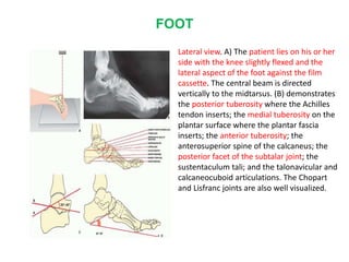 FOOT
Lateral view. A) The patient lies on his or her
side with the knee slightly flexed and the
lateral aspect of the foot against the film
cassette. The central beam is directed
vertically to the midtarsus. (B) demonstrates
the posterior tuberosity where the Achilles
tendon inserts; the medial tuberosity on the
plantar surface where the plantar fascia
inserts; the anterior tuberosity; the
anterosuperior spine of the calcaneus; the
posterior facet of the subtalar joint; the
sustentaculum tali; and the talonavicular and
calcaneocuboid articulations. The Chopart
and Lisfranc joints are also well visualized.
 