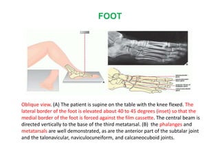 FOOT
Oblique view. (A) The patient is supine on the table with the knee flexed. The
lateral border of the foot is elevated about 40 to 45 degrees (inset) so that the
medial border of the foot is forced against the film cassette. The central beam is
directed vertically to the base of the third metatarsal. (B) the phalanges and
metatarsals are well demonstrated, as are the anterior part of the subtalar joint
and the talonavicular, naviculocuneiform, and calcaneocuboid joints.
 