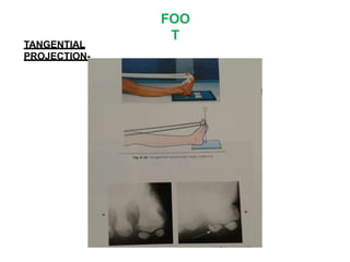 FOO
T
TANGENTIAL
PROJECTION-
 