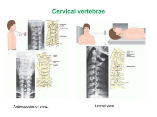 Cervical vertebrae
Lateral view
Anteroposterior view.
 