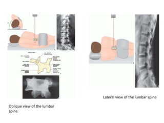 Lateral view of the lumbar spine
Oblique view of the lumbar
spine
 